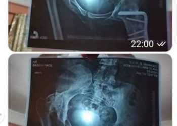 لامية بولغلب بين امل والم