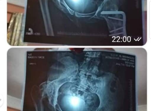 لامية بولغلب بين امل والم